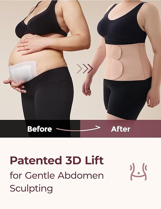 Momcozy Ergowrap Postpartum Belly Band for Natural and C-Section Recovery, Abdominal Binder with 3D Abdomen Lifting & Ergonomic Back Support, Seamless Belly Wrap Shapewear for Post Surgery Recovery
